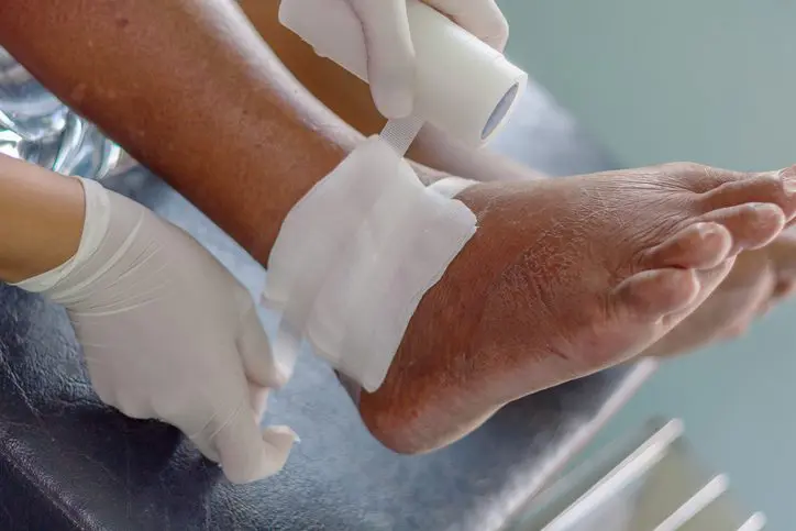 gout ankle Patch on swelled foot.
