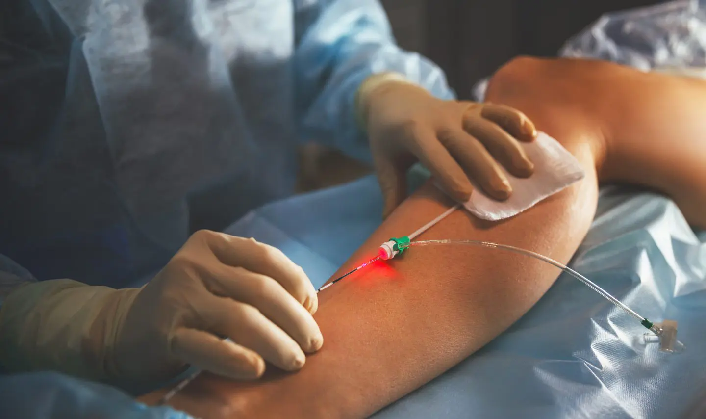 doctor-and-an-assistant-in-the-operating-room-for-surgical-venous-vascular-surgery-clinic