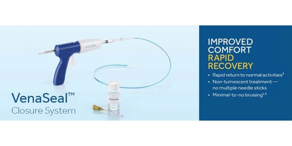 VenaSeal Vein Closure