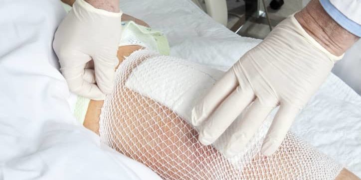 Preparing for Knee Replacement Surgery Preparing for Knee Replacement Surgery