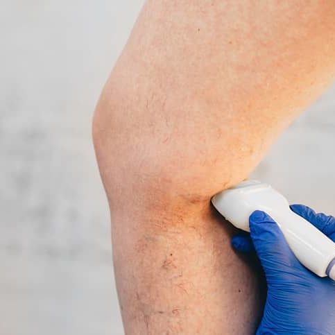 Vein Management Vein Management