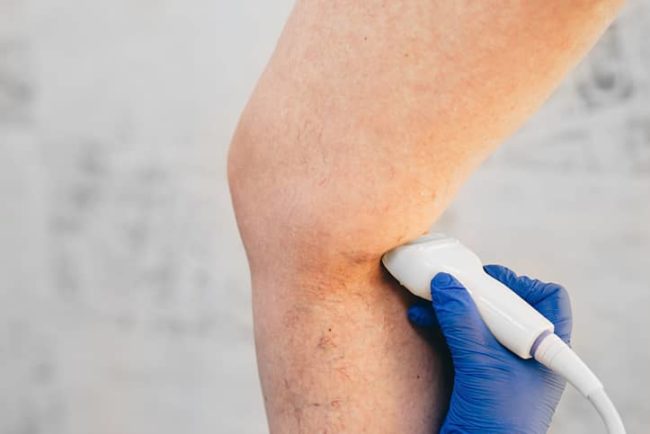 Vein Management Vein Management