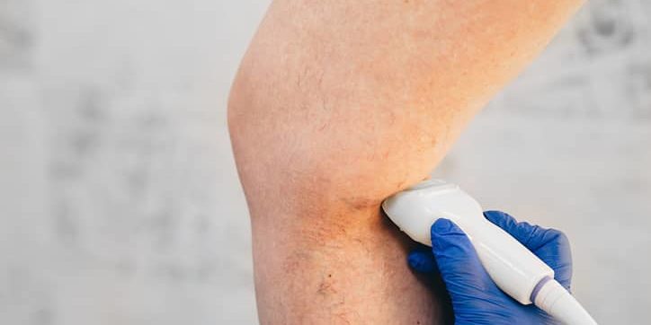Vein Management Vein Management