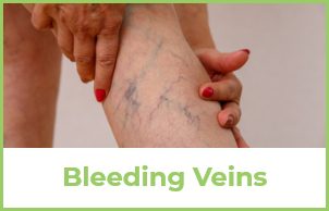Bleeding Veins Example
