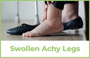 Swollen Achy Legs Example