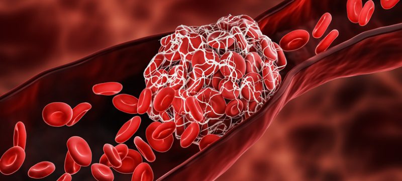 Vein Blocked by Cells